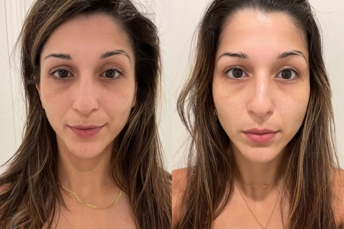 Before and after comparison images from using Brightening Support Vital Concentrate