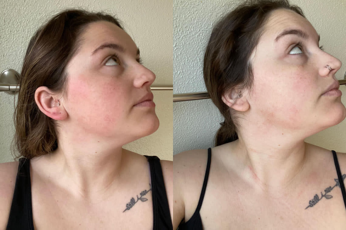Before and after comparison images from using BioEvolve Moisturizer