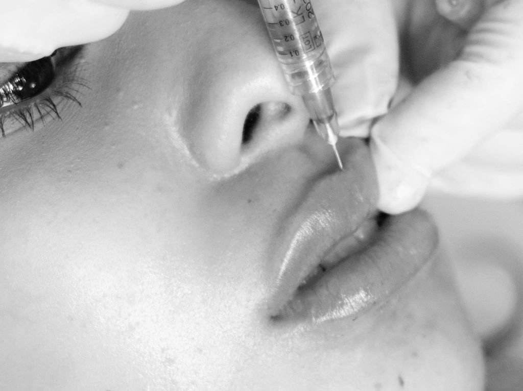 Woman's lips getting injected with filler