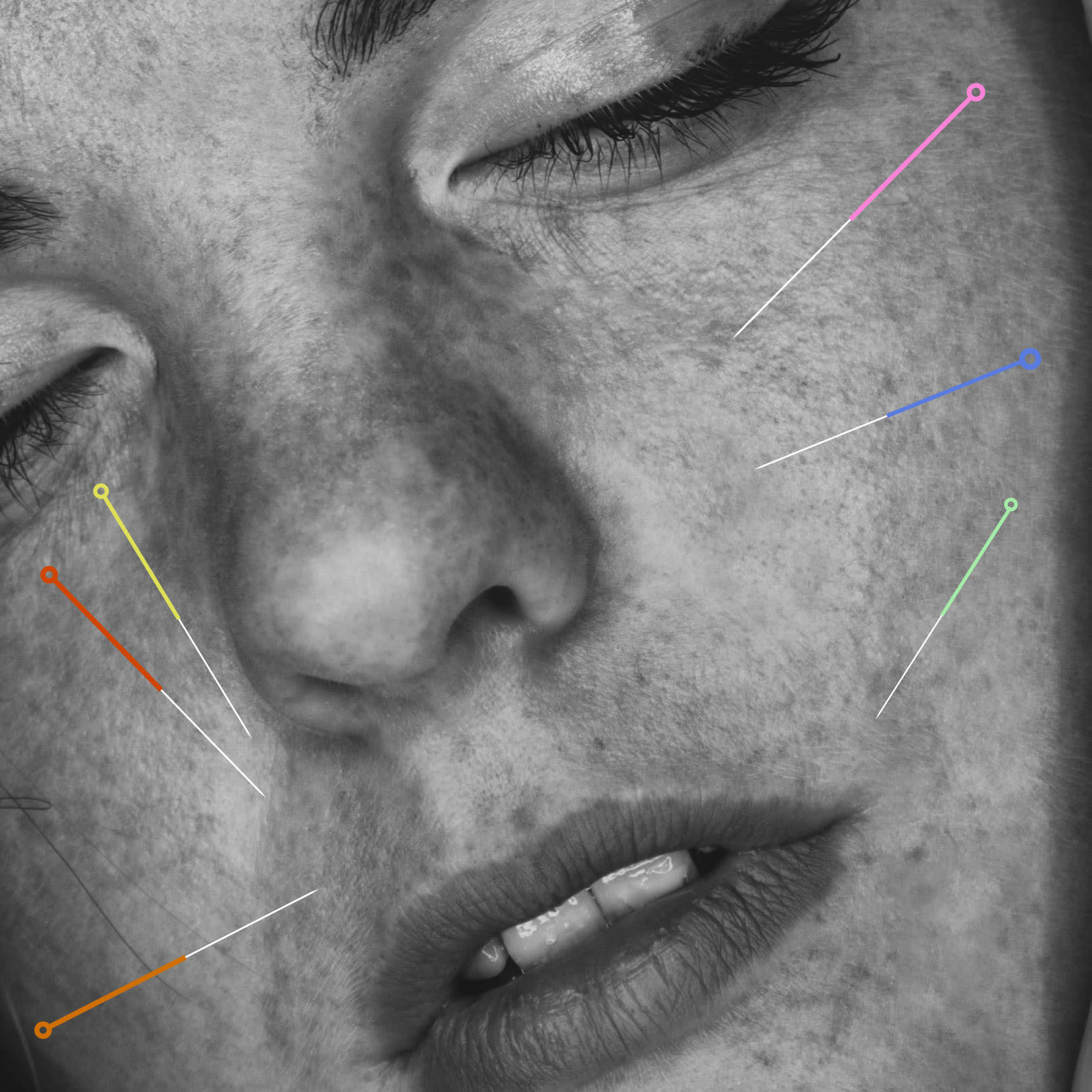 Woman's face with colorful acupuncture needles 