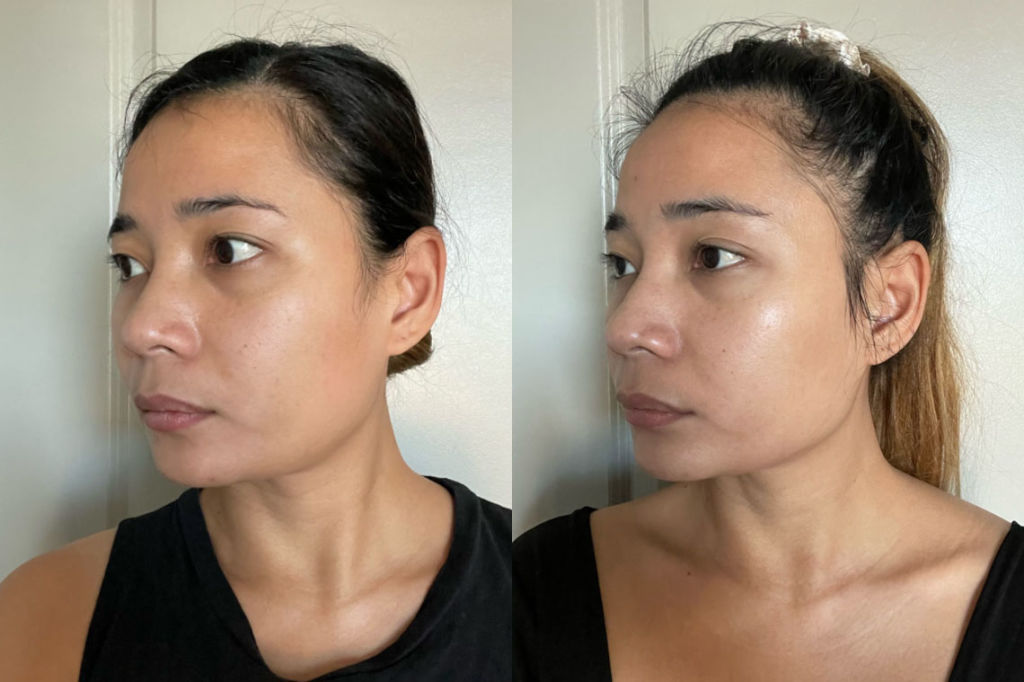 Before and after comparison images from using BioEvolve Serum