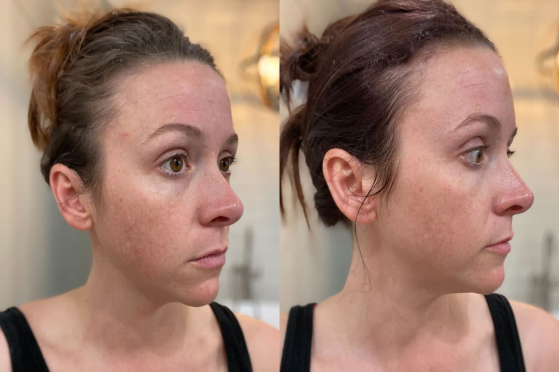 Before and after comparison images from using Brightening Support Vital Concentrate 