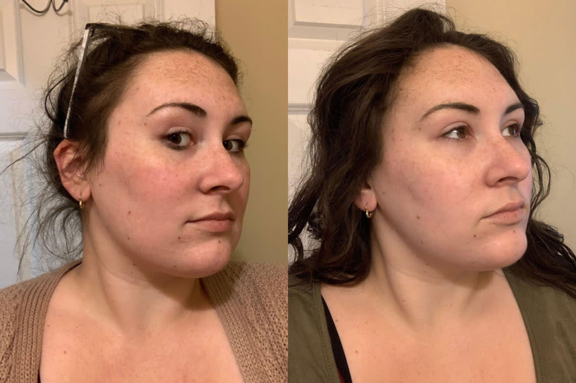 Before and after comparison images from using BioEvolve Moisturizer