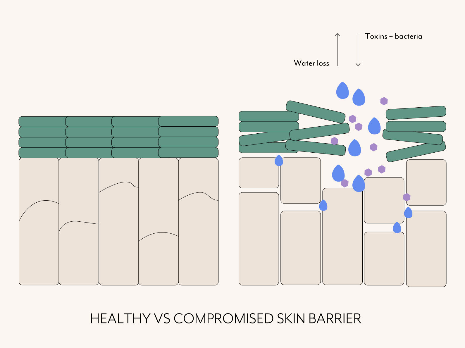 Graphic showing healthy skin barrier vs compromised with TEWL