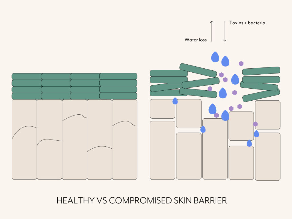Graphic showing healthy skin barrier vs compromised with TEWL