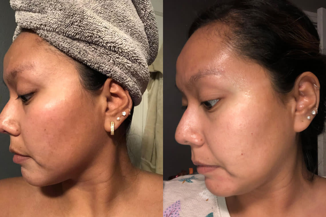 Before and after comparison images from using Brightening Support
