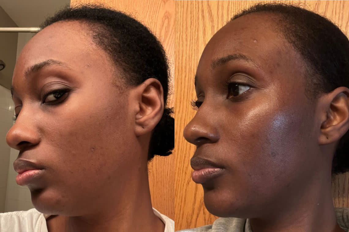 Before and after comparison images from using BioEvolve Serum