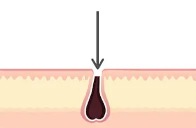 Illustration of skin contacting foil holes to expose hair for cutting