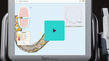 Watch TimeLapse Technology video