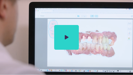 Watch iTero®: Your Digital Partner with Dr. Thierry Nathan, DDS video