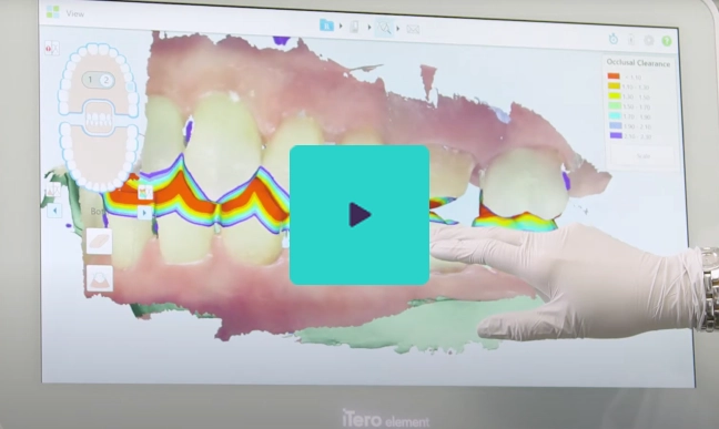 Watch How to Use the Eraser Tool to Adjust Your Digital Model video