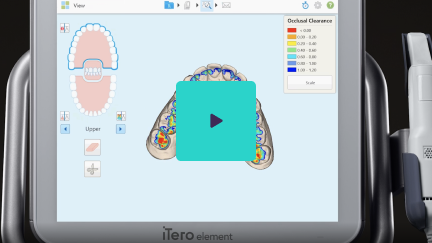 Watch Occlusogram video