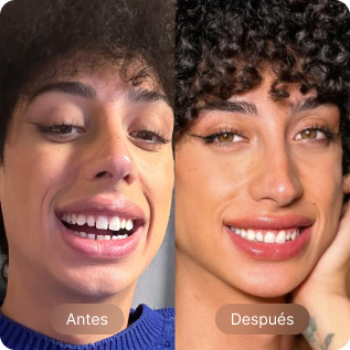 Before-After card