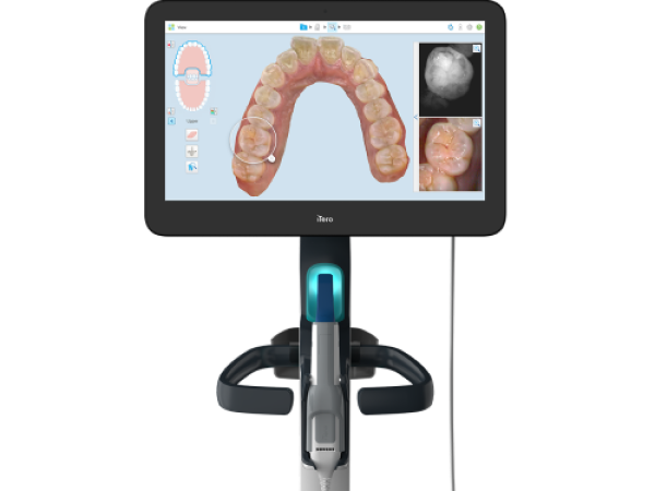 iTero: Intraoral Scanner | Digital Impressions for Dental And ...