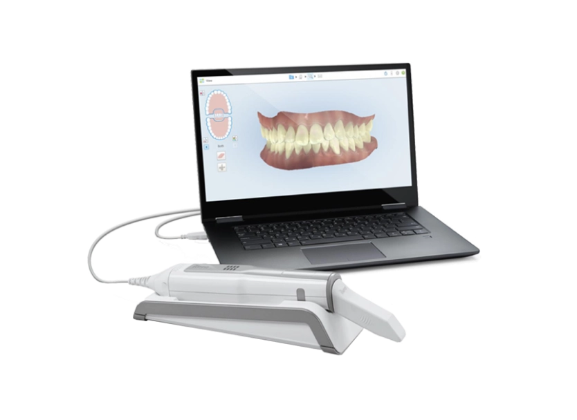 Itero Element Flex Foundation Portable Intraoral Scanner Itero