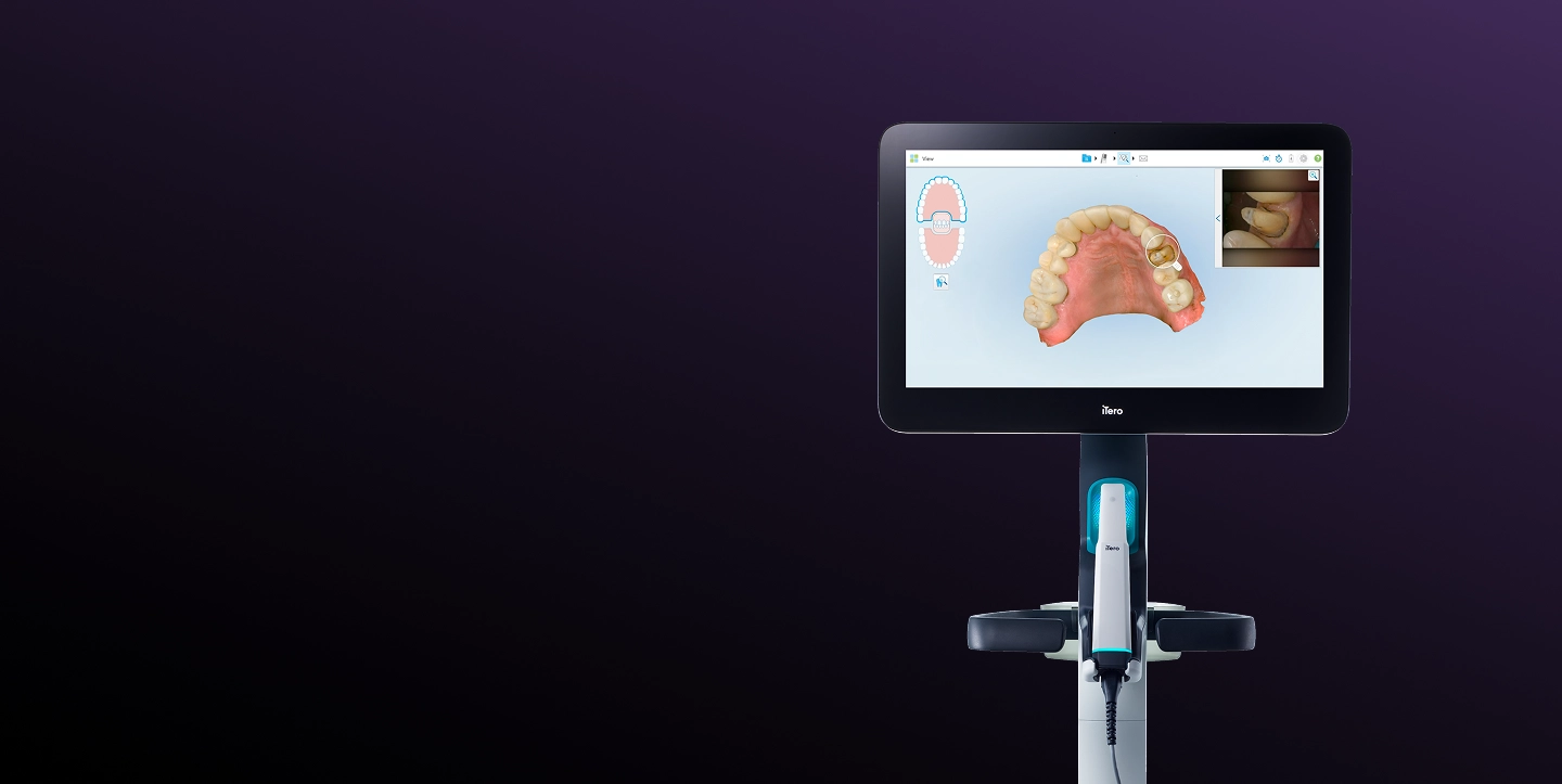 iTero Lumina intraoral scanner | iTero