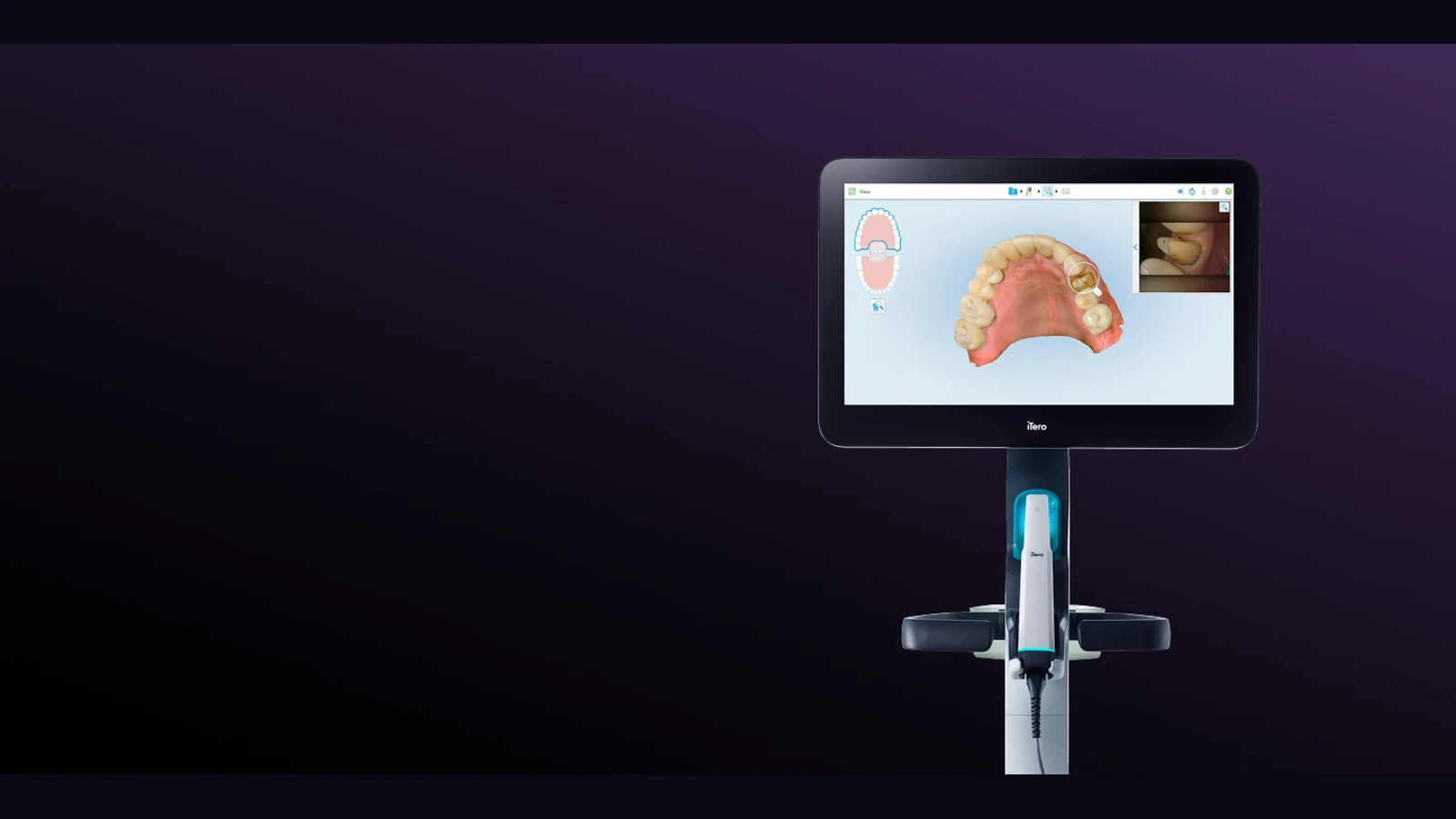 iTero scanner intraoral: vale a pena? Comparativo antes de comprar