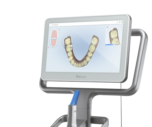 Intero Scan Intraoral Scanner Product Information | Purchasing Options | iTero