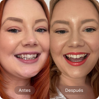 Before-After card