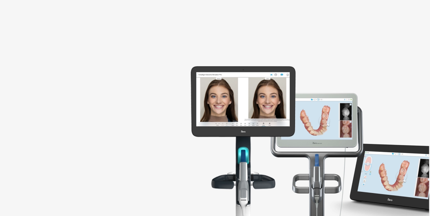 Dental 3D Intraoral Scanners Explore Our Solutions iTero