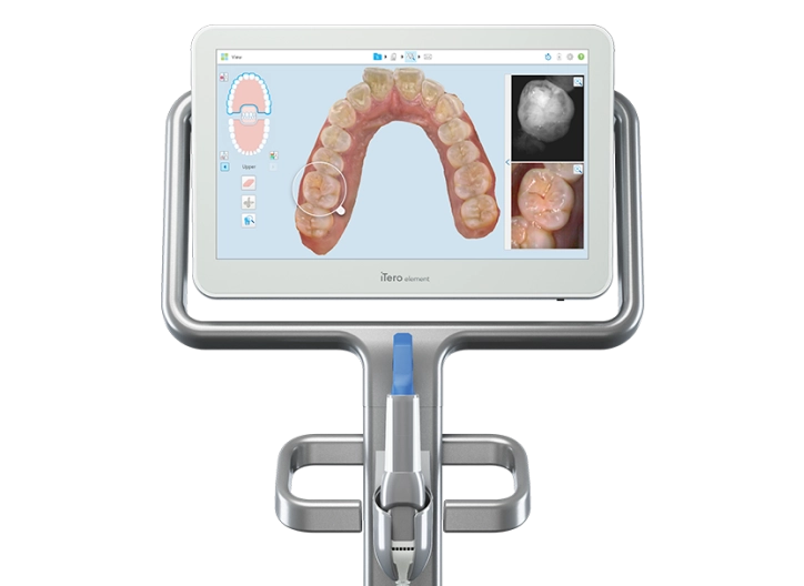 ITERO SCANNER — Valiente Dental