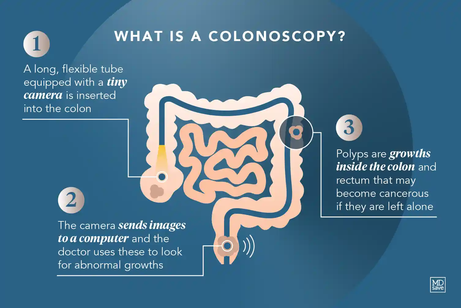 Mar-2023 Colonoscopy Resource-Center-1505x1005 Image-2