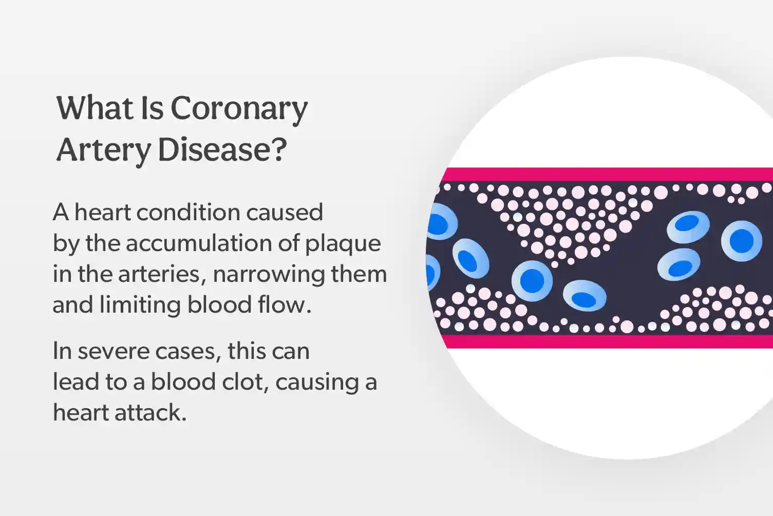 MDsave-Blog Heart-Health September-2025-2
