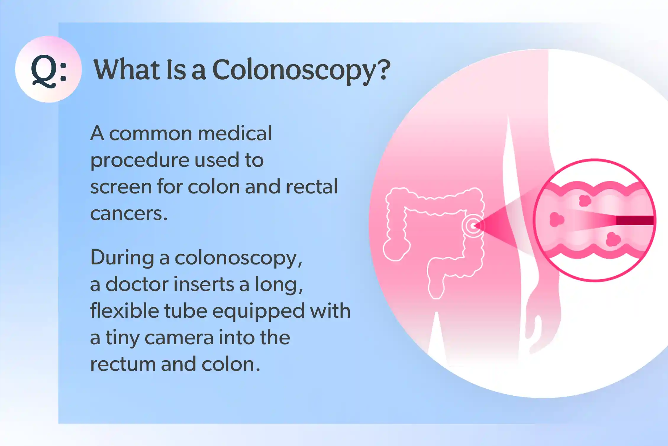 What is a colonoscopy
