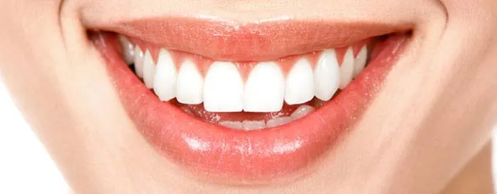 더 환하게 웃을 수 있을까요? 치아 착색이 있는지 확인하는 법을 알려드립니다. article banner
