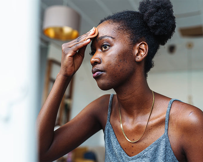 How to Get Rid of Cystic Acne: Expert Tips for Clearer Skin | IPSY