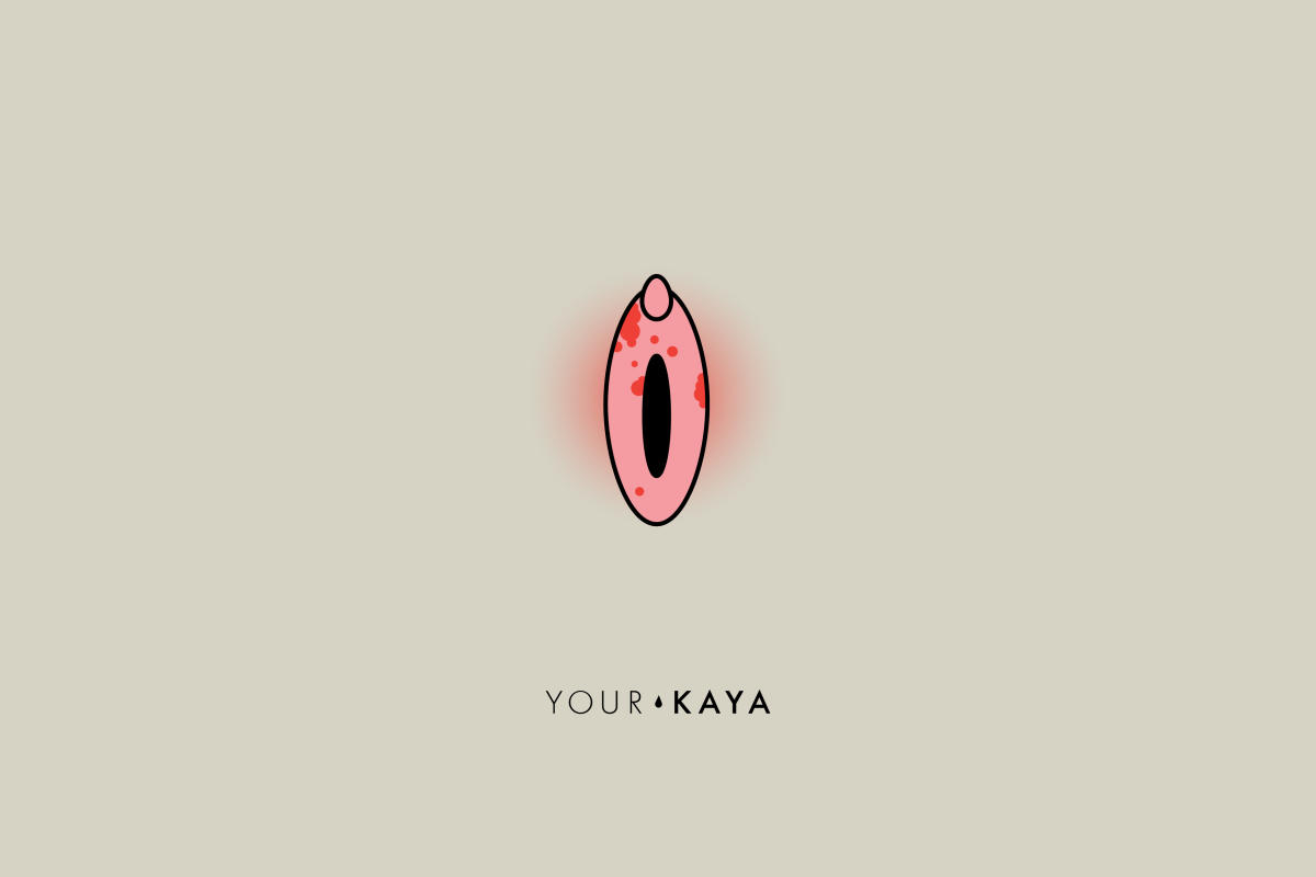 Vaginal fungus illustration