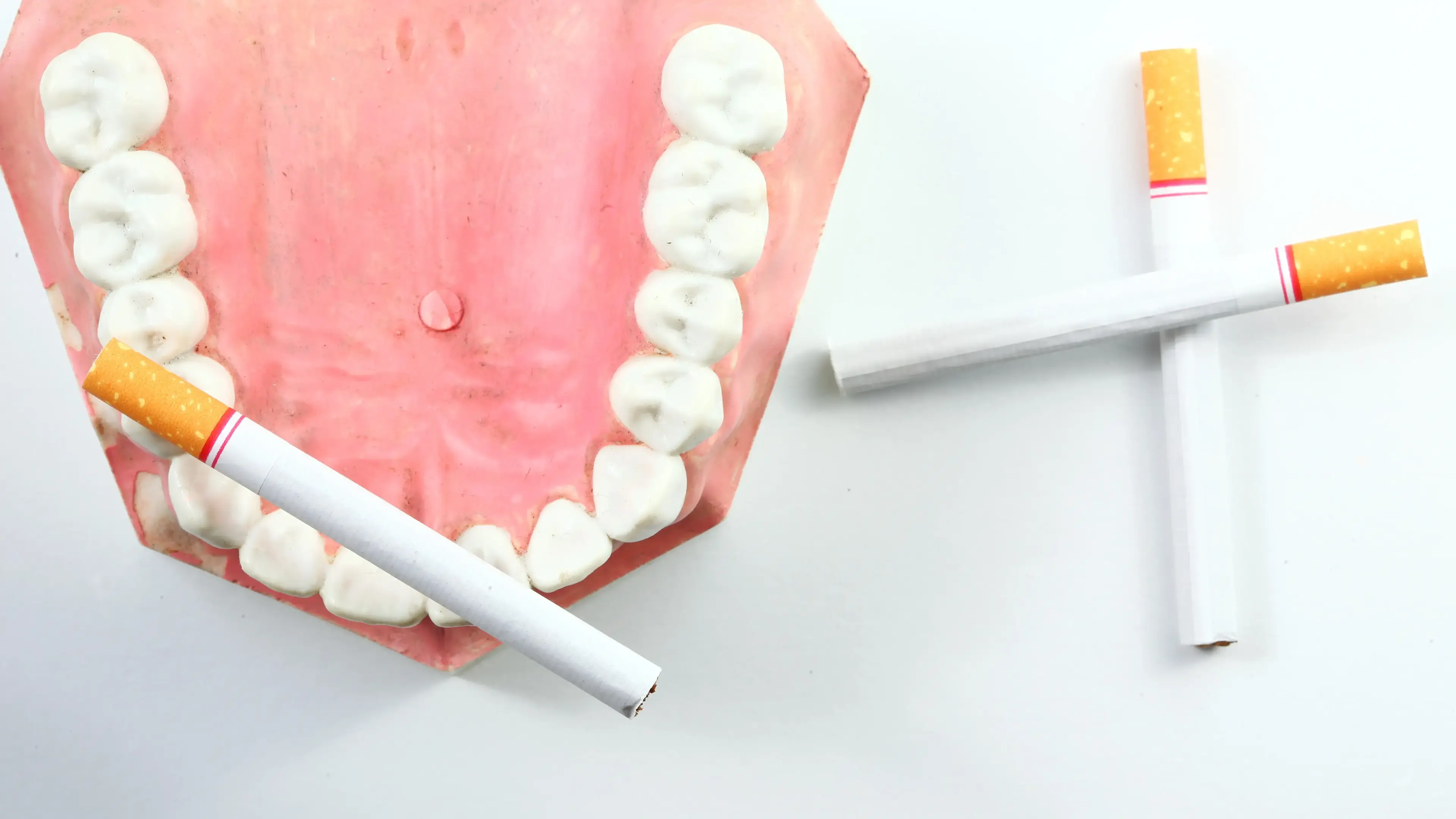 Ein künstliches Gebiss mit einer Zigarette darauf.