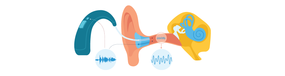 Blogue - L'entretien des appareils auditifs - Lobe
