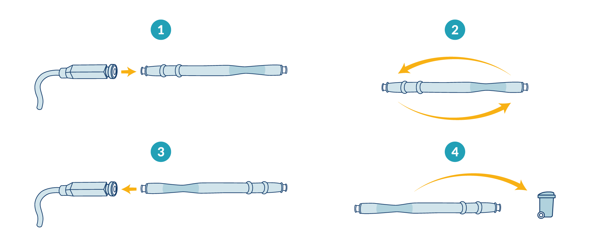 Remplacement-pare-cerumen