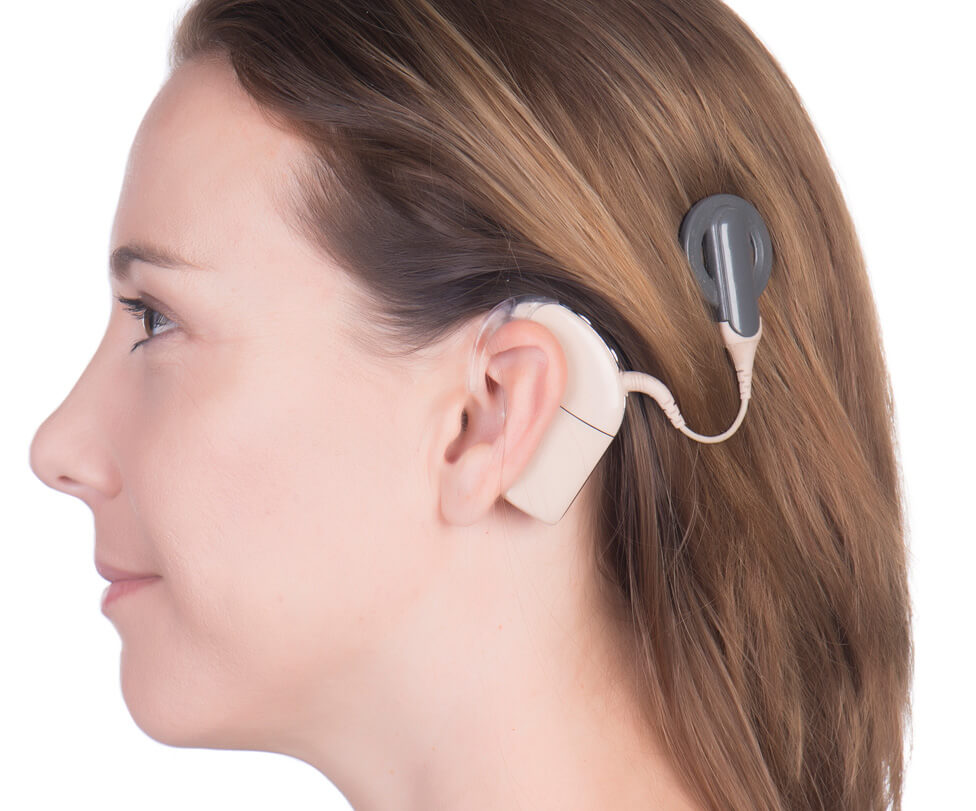 Телефон для слабослышащих купить. Аппарат Cochlear кохлеарный. Слуховой аппарат super Ear 2000. Кохлеарный имплант кохлеар. Слуховой аппарат Helix hearing модель 02976.