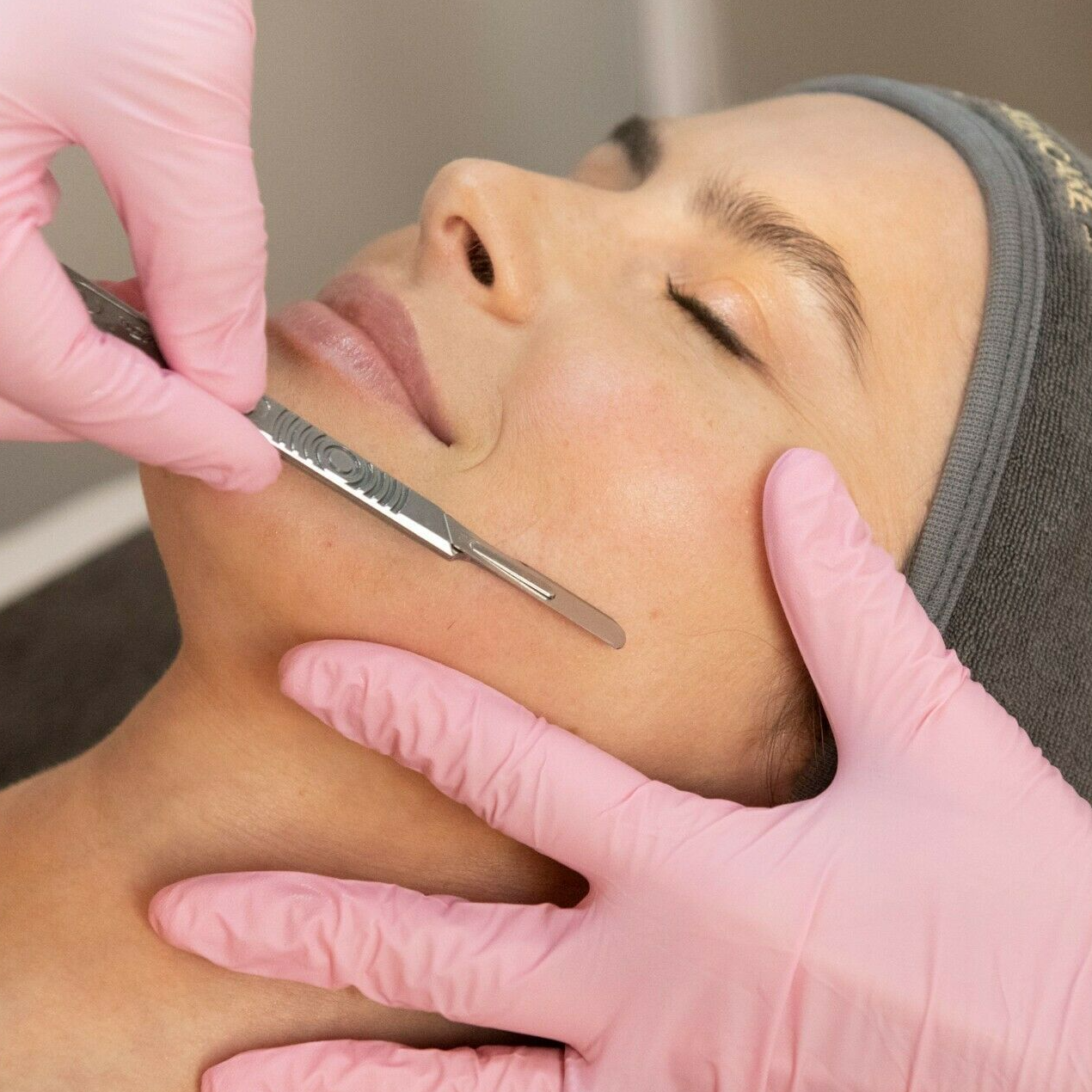 Dermaplaning