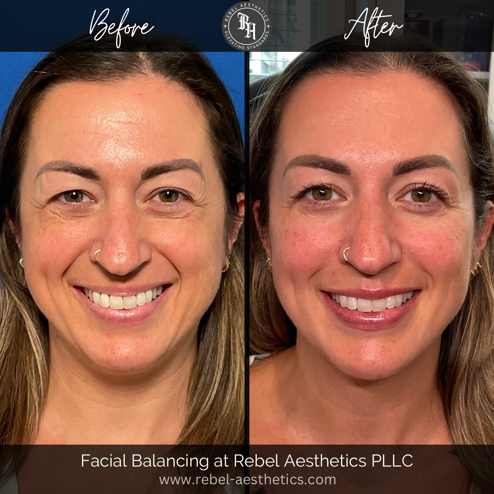 Facial Balancing
