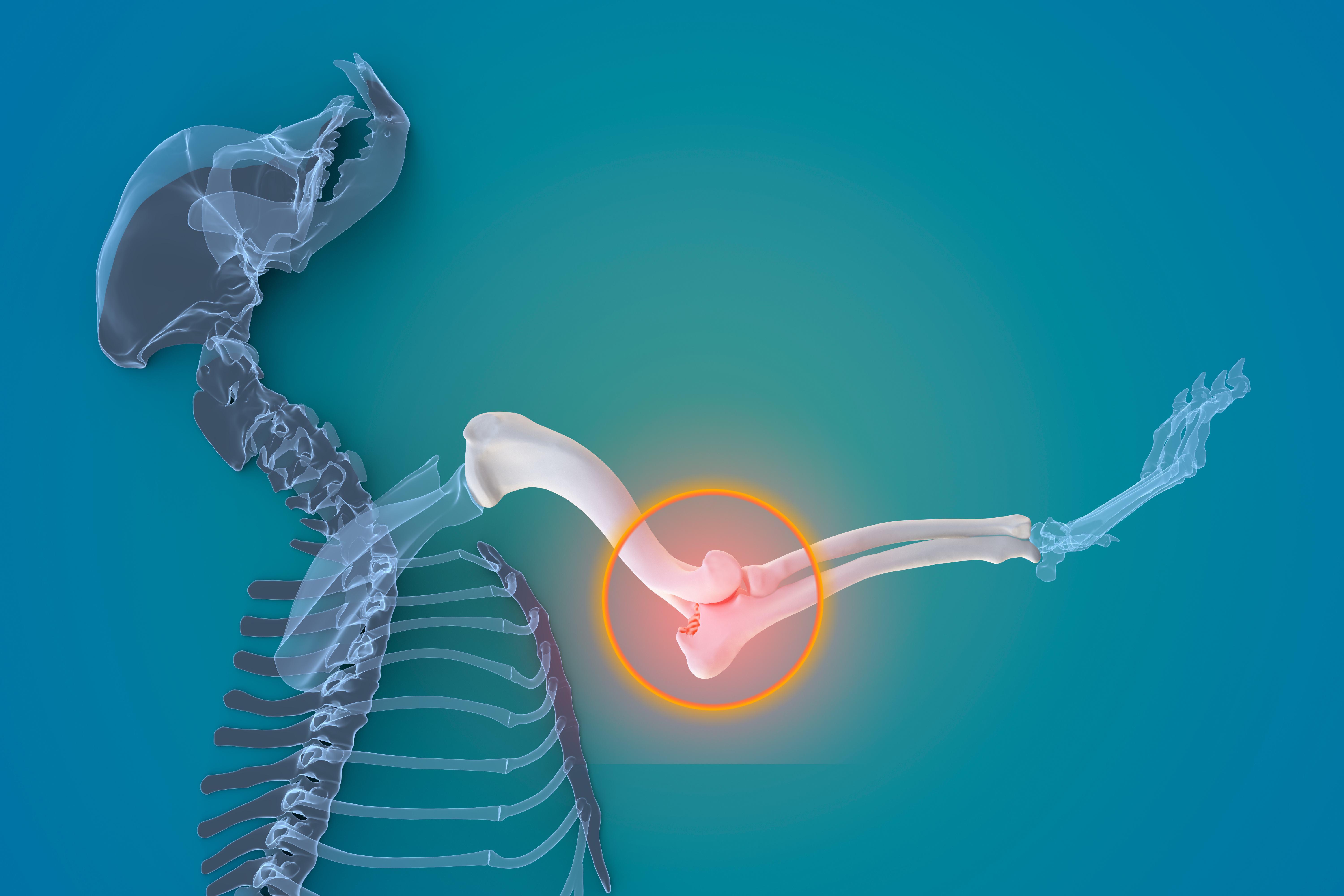 Elbow Dysplasia in Dogs