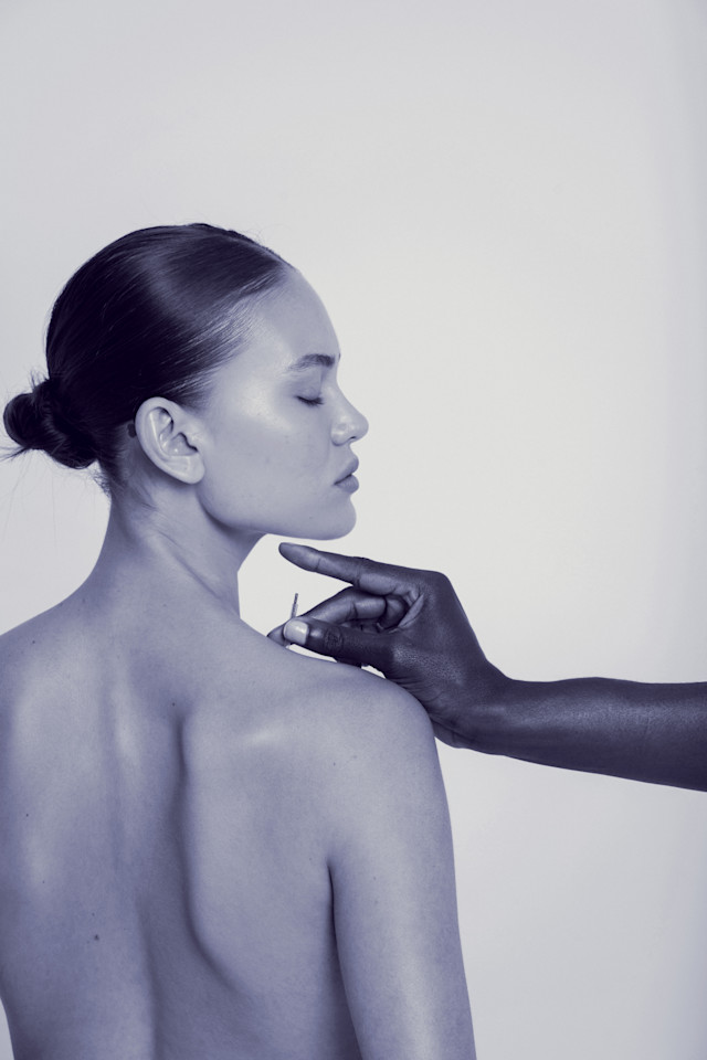 It’s Not Fitness. It’s Life. EQXM_EDT_ORA_ACUPUNCUTRE_ON_THE_BODY_23_449_6606