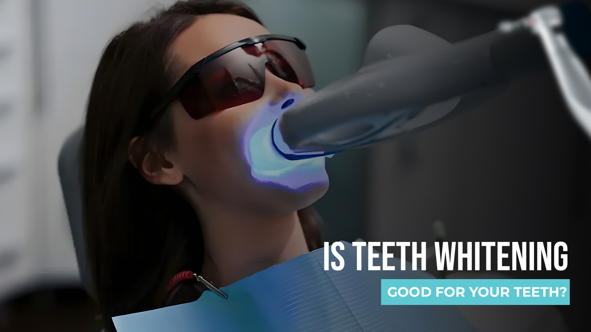 Is Teeth Whitening Good for Your Teeth? An Honest Answer From a Canberra Dentist