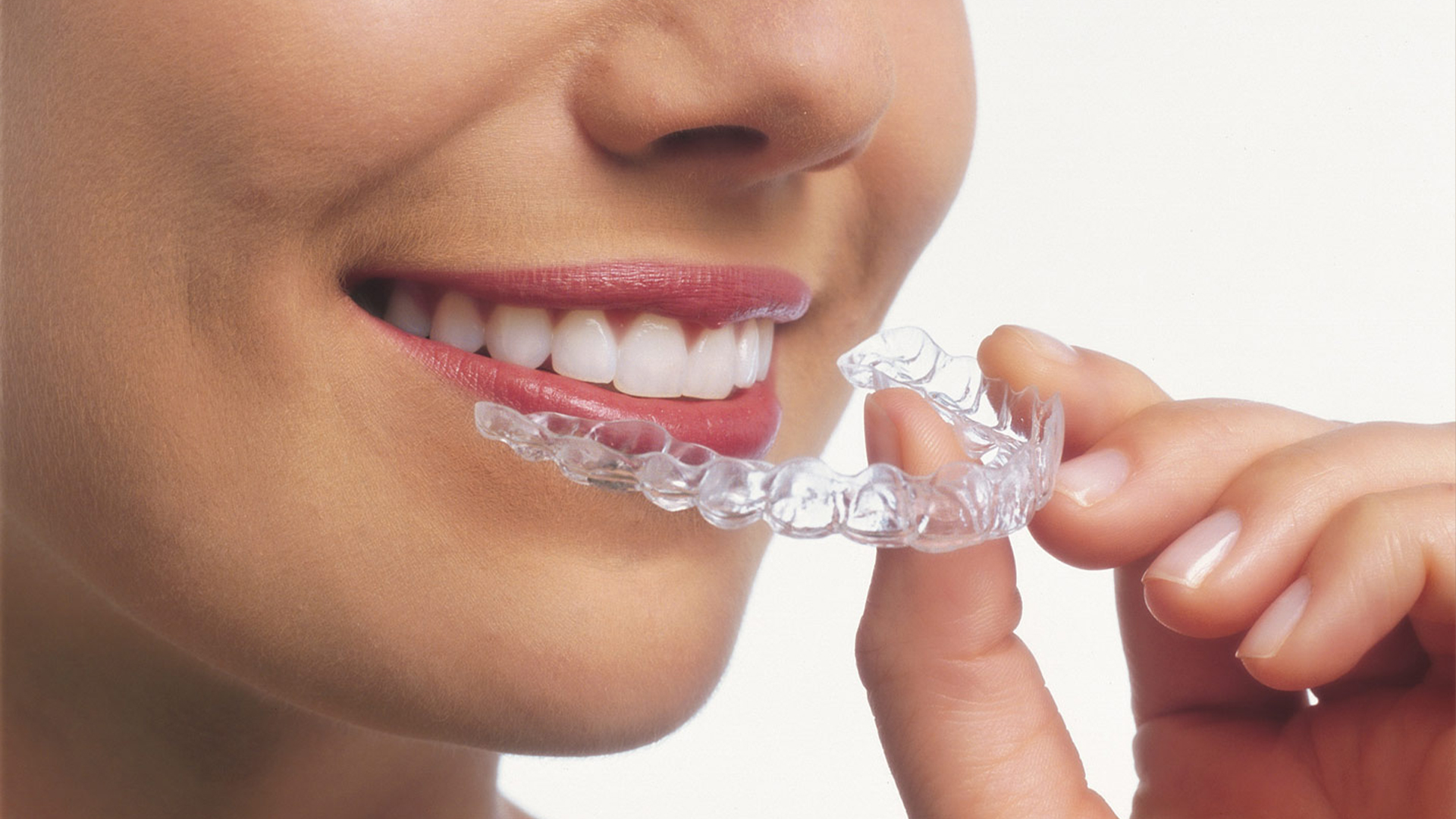 Invisalign Aligners for Teeth: How They Work, Cost & vs Braces