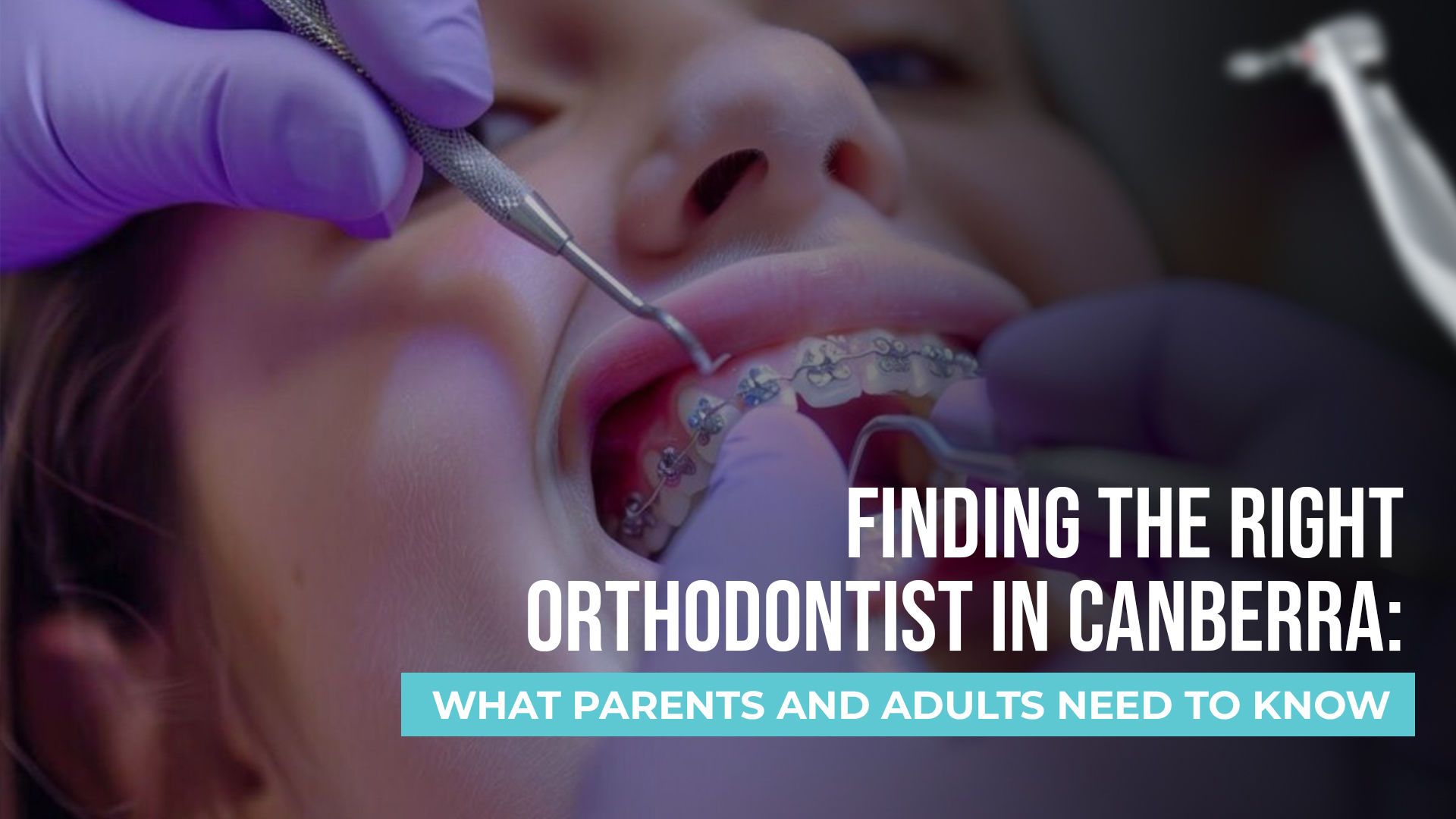 Finding the Right Orthodontist in Canberra: What Parents and Adults Need to Know