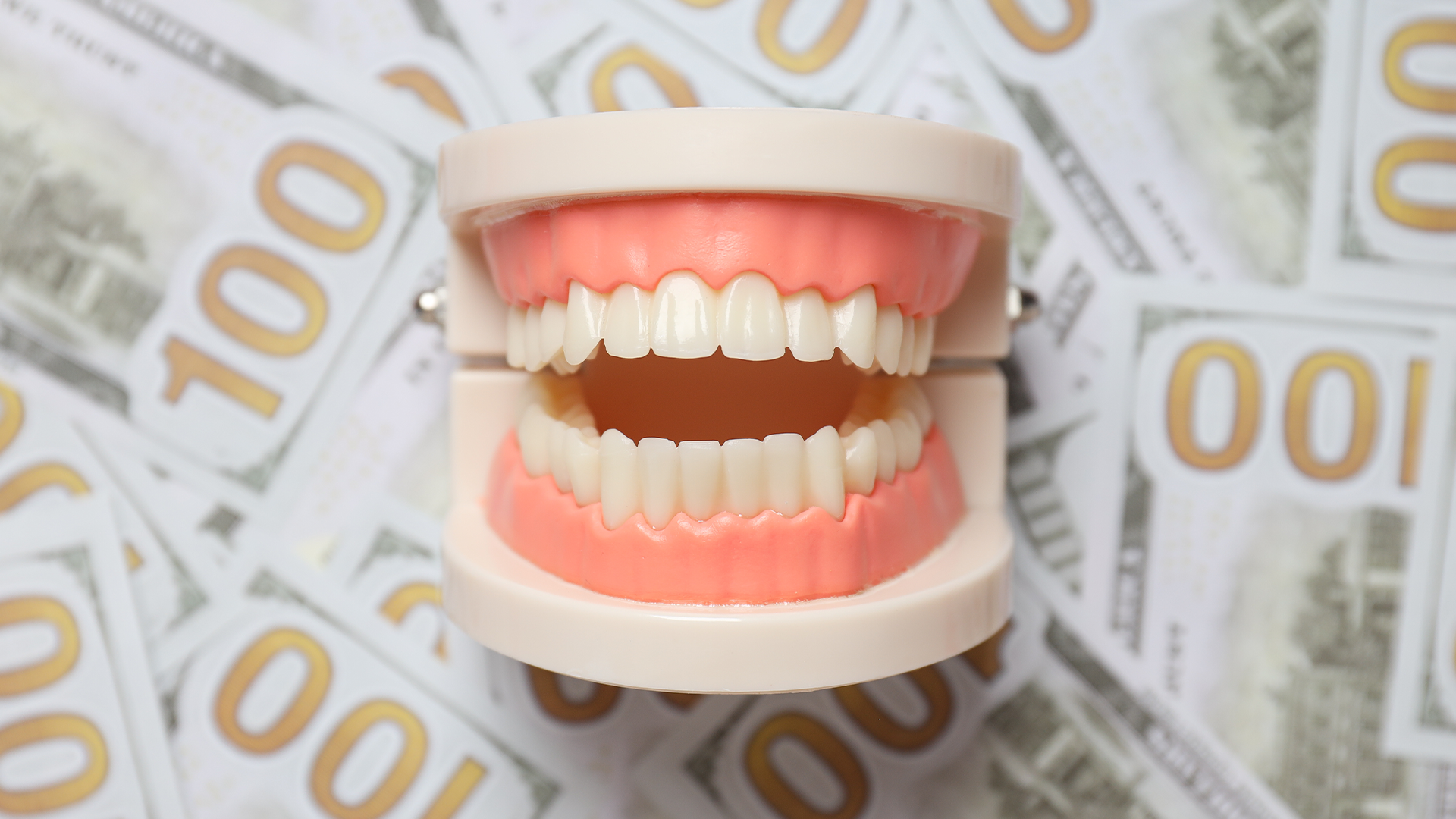 The Cost of Common Dental Treatments