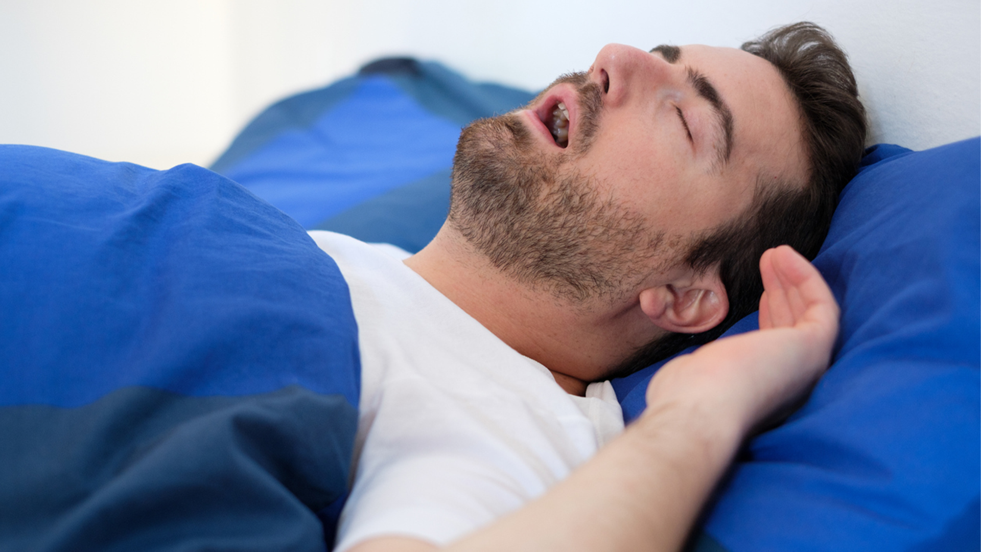 Mouth Breathing