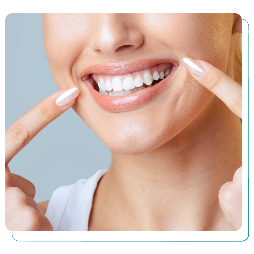 Smile Makeover