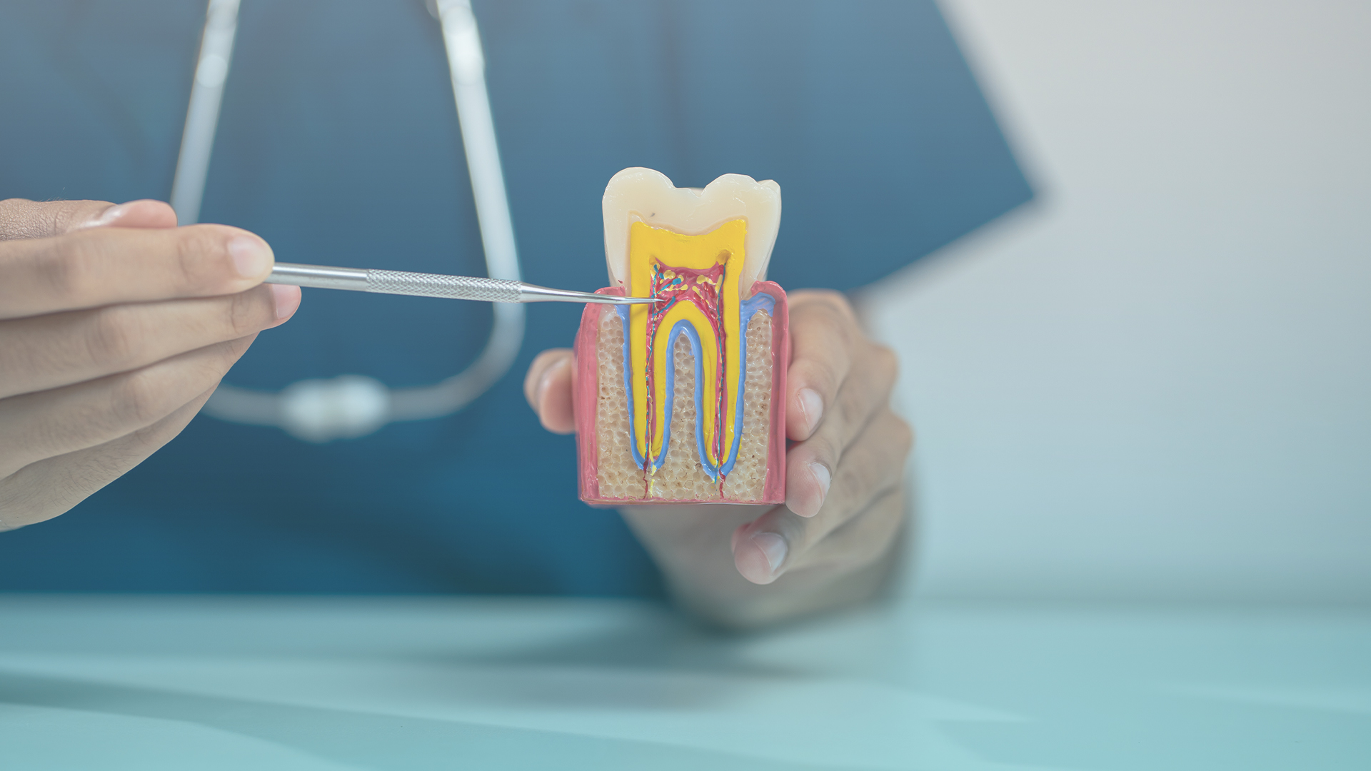 Root Canal Treatment Canberra