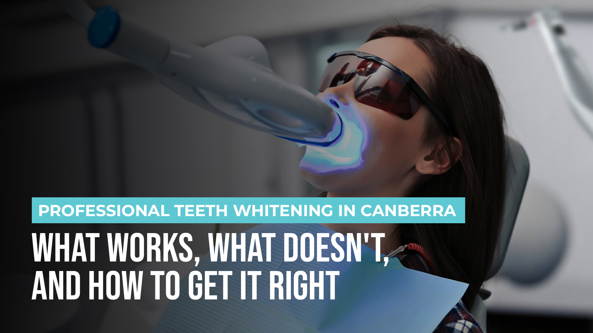 Professional Teeth Whitening in Canberra: What Works, What Doesn’t, and How to Get It Right