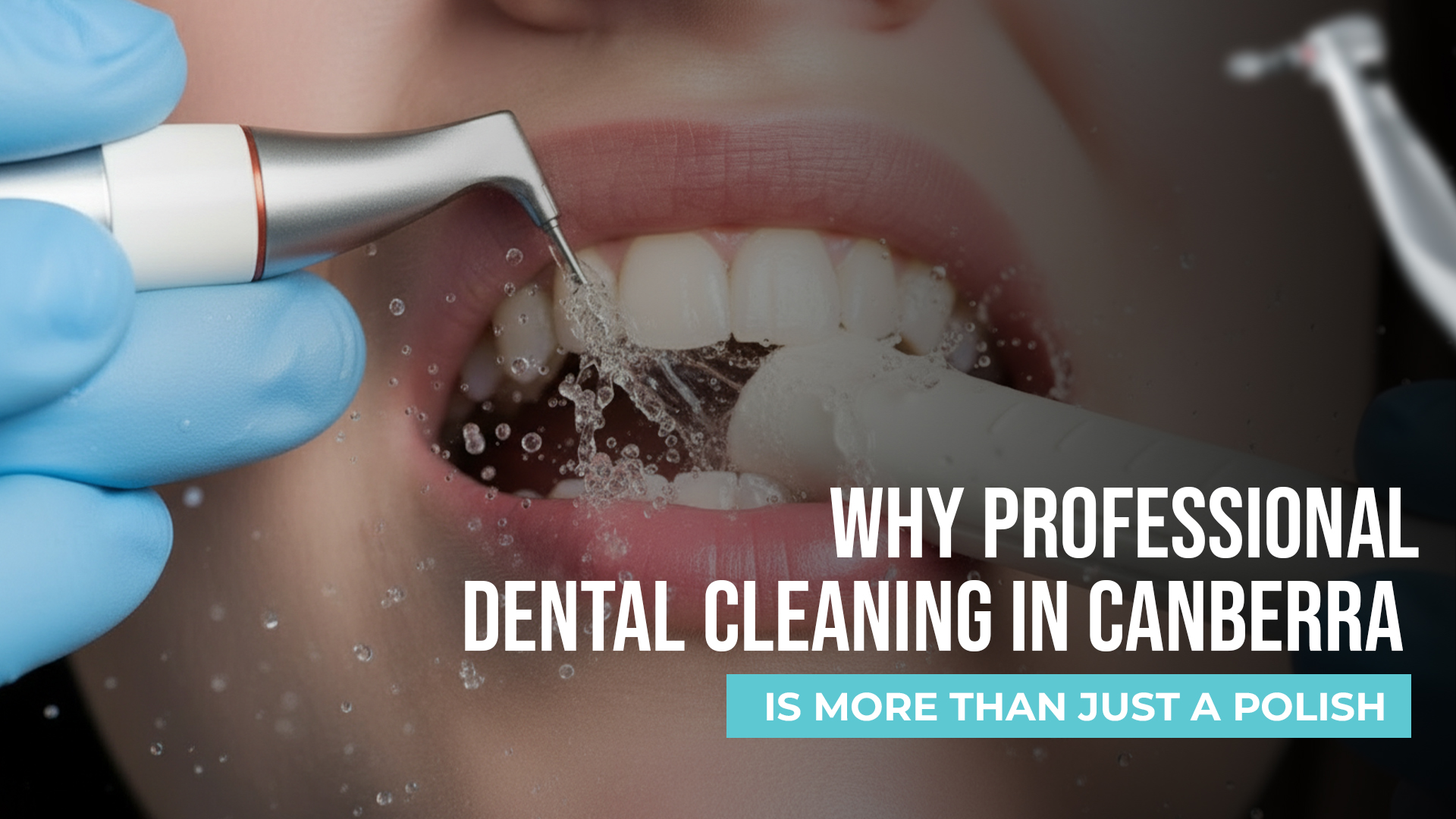 Why Professional Dental Cleaning in Canberra Is More Than Just a Polish