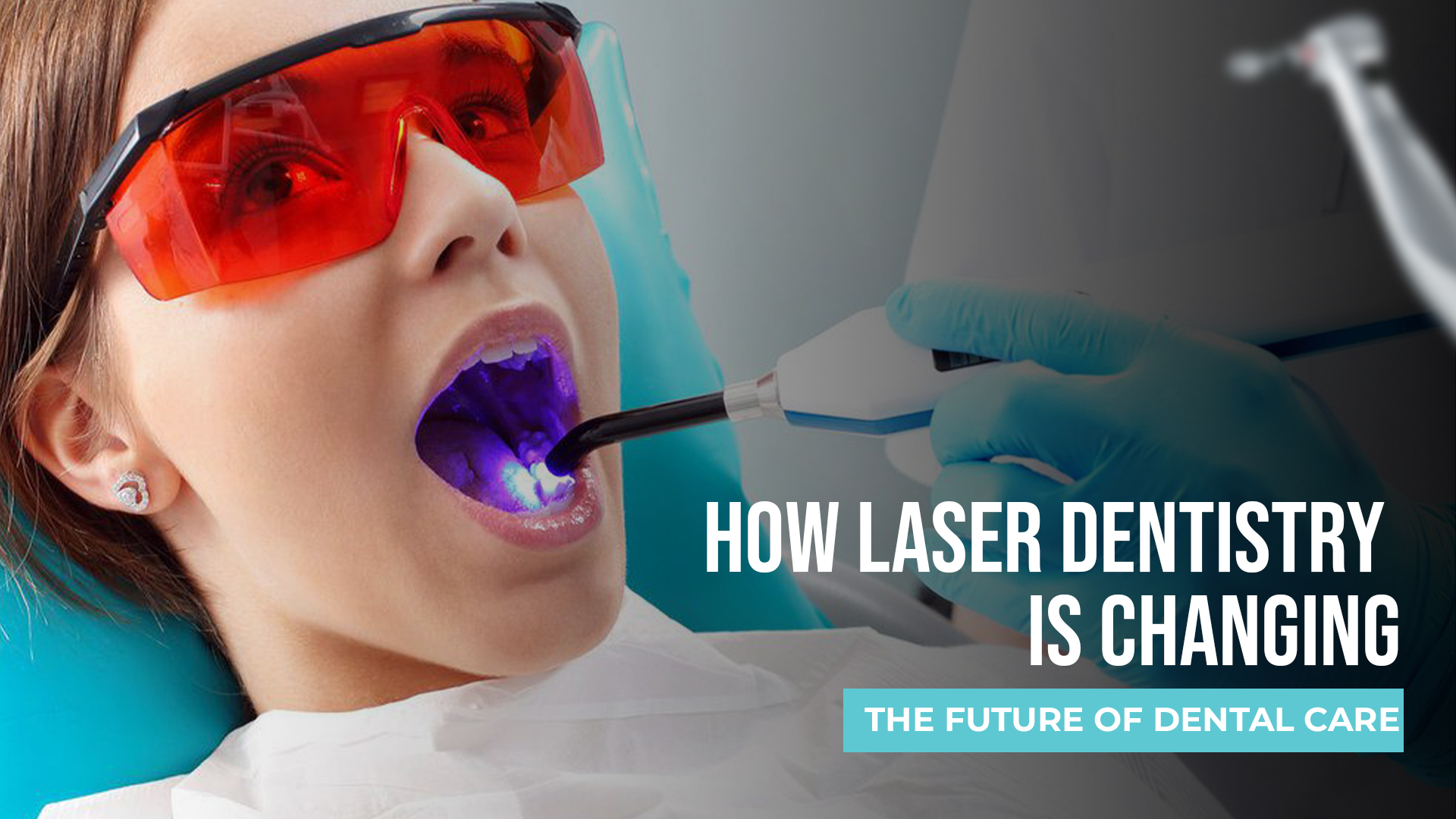 How Laser Dentistry Is Changing the Future of Dental Care