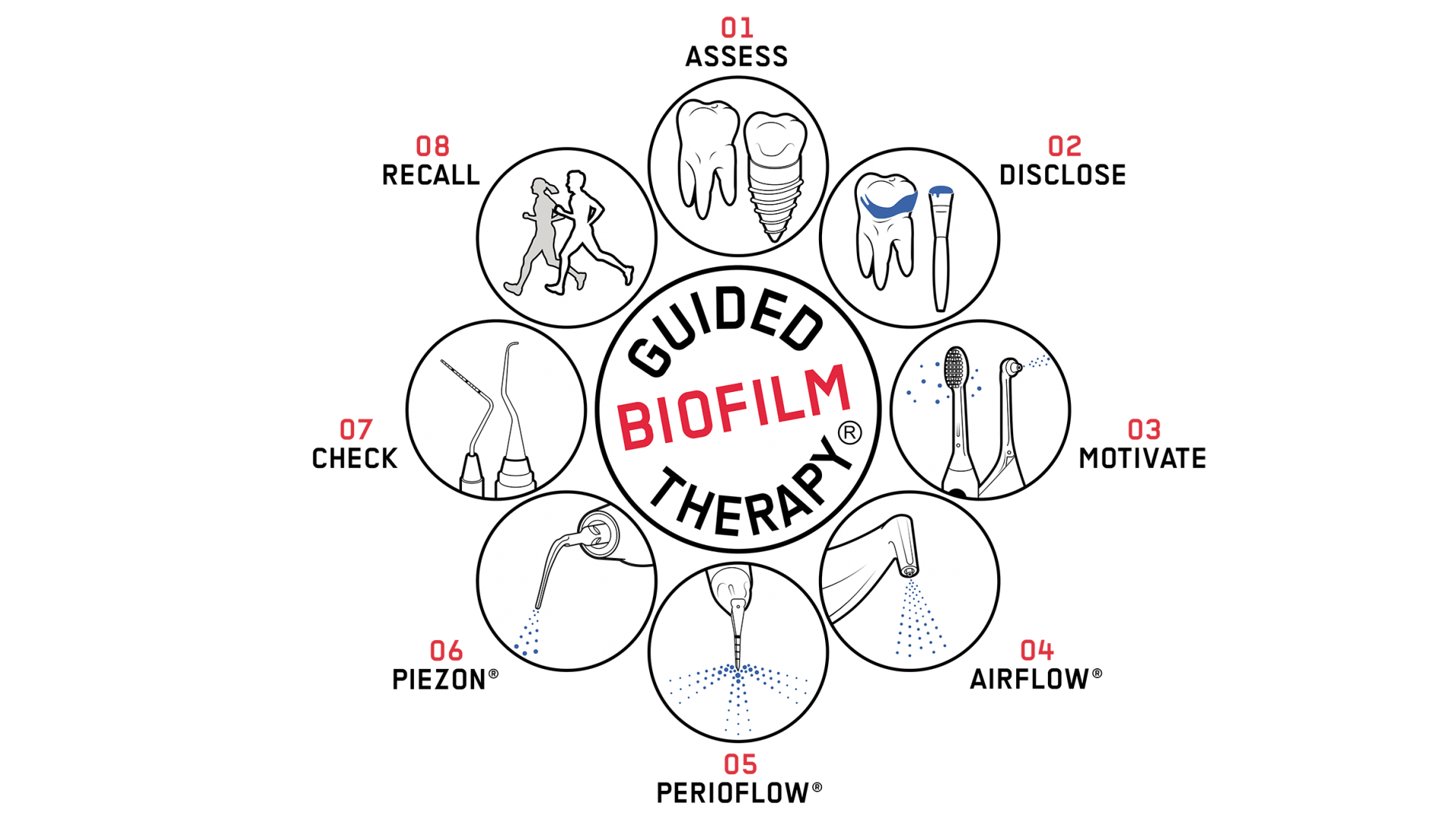 EMS Airflow Guided Biofilm Therapy